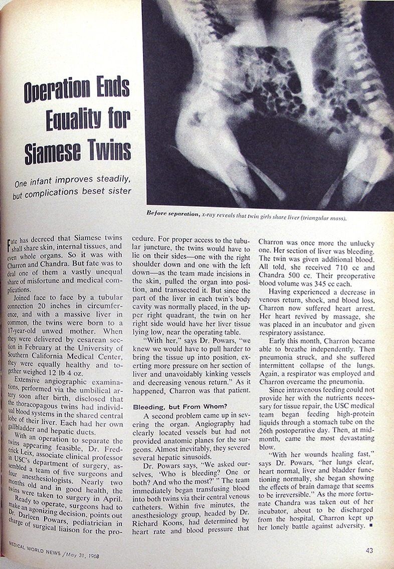 "Operation Ends Equality for Siamese Twins," an article in the May 31, 1968 issue of Medical World News. Medical World News Collection, McGovern Historical Collection, IC077, 5/31/1968.